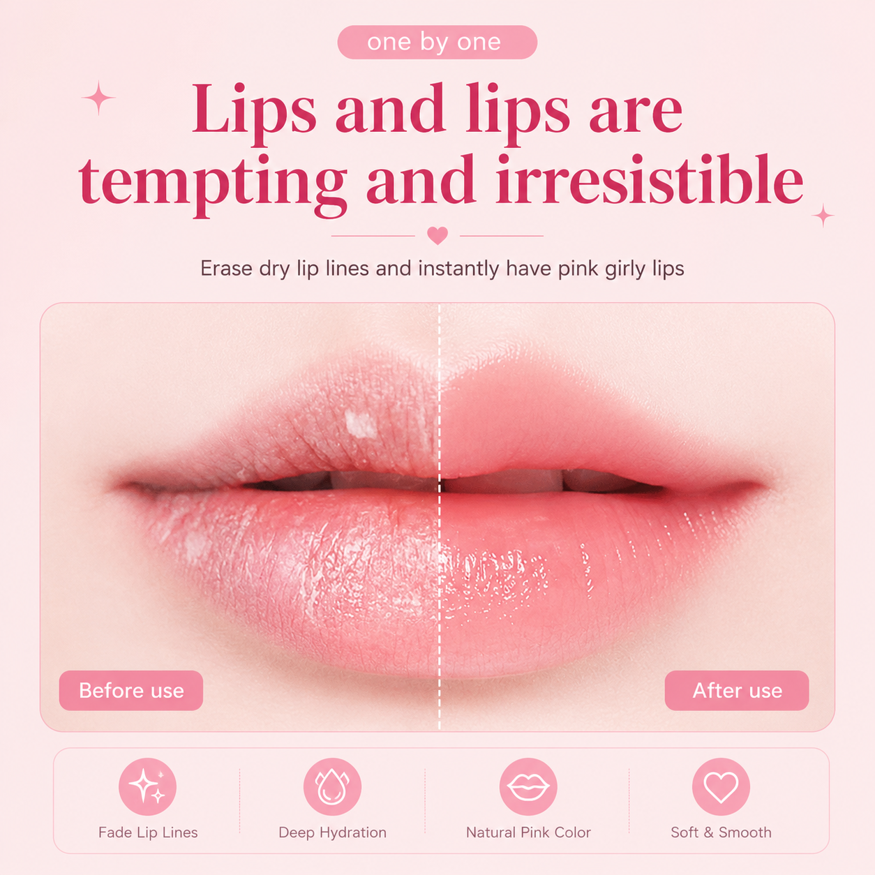 SoftLips Overnight Balm™